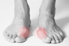 How Podiatrists Diagnose and Treat Common Foot Problems