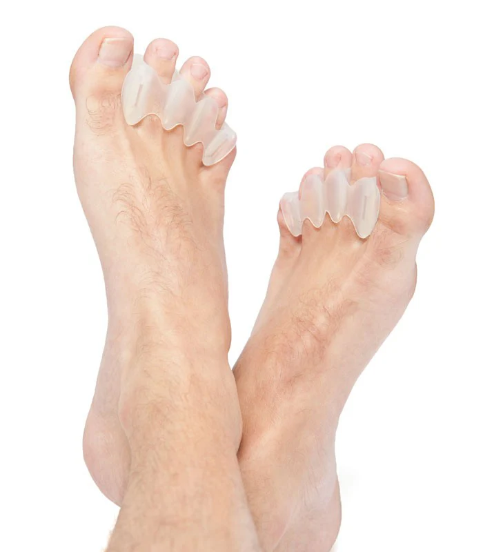 The Impact of Bunions on Your Daily Activities and How to Manage It