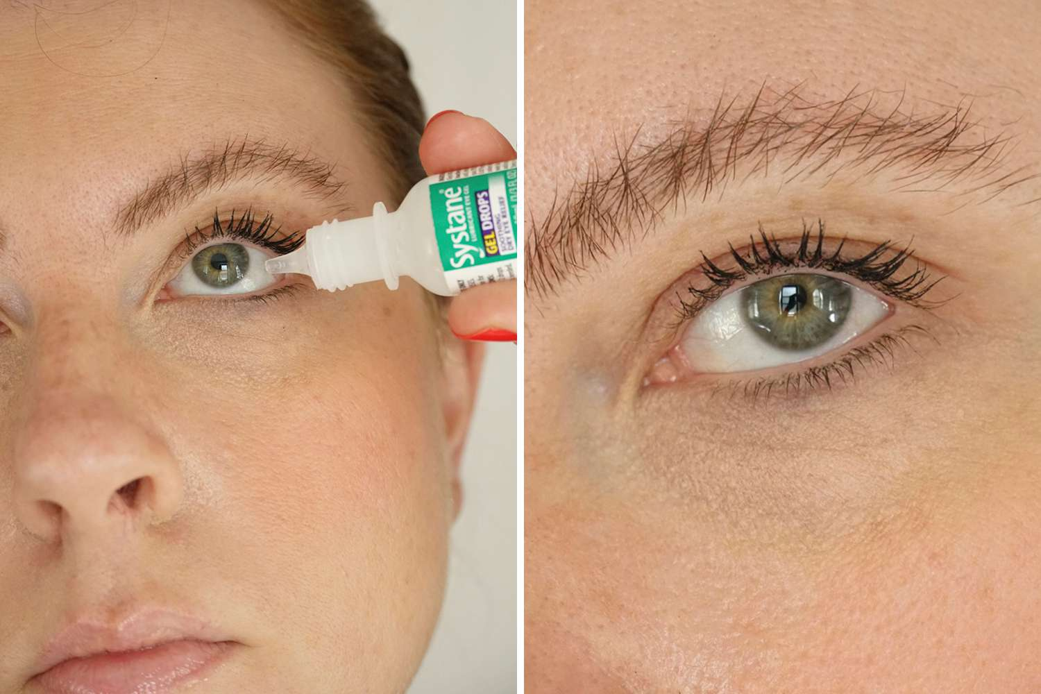 Best Eye Drops for Dry Eyes Due to Allergies – A Simple Guide!