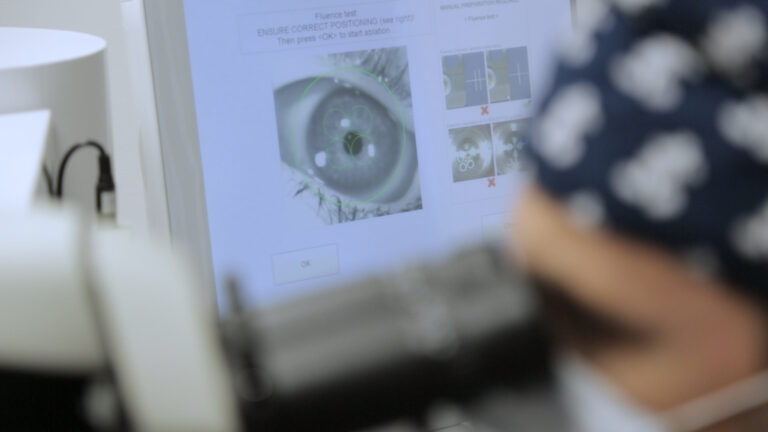 Custom Lasik: Long-Term Benefits and Considerations for Eye Health