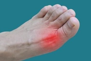 Exploring the Causes and Symptoms of Flat Feet