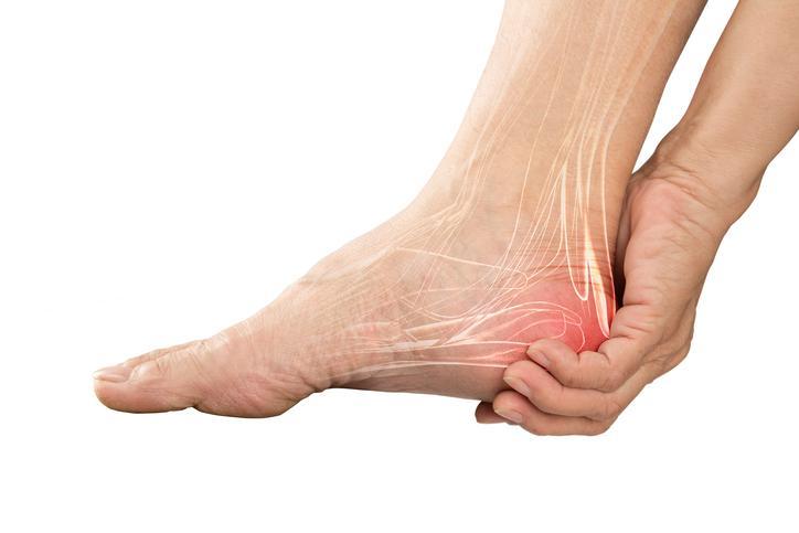 Surgical Options for Severe Heel Pain: When To Consider It
