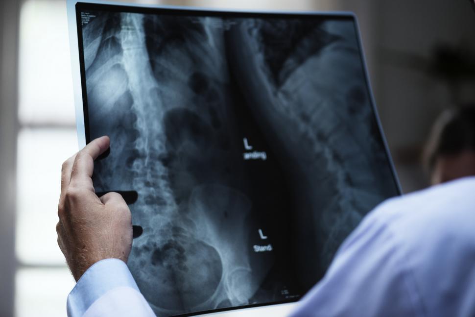 The Role of Imaging Technology in Spine Surgery Planning