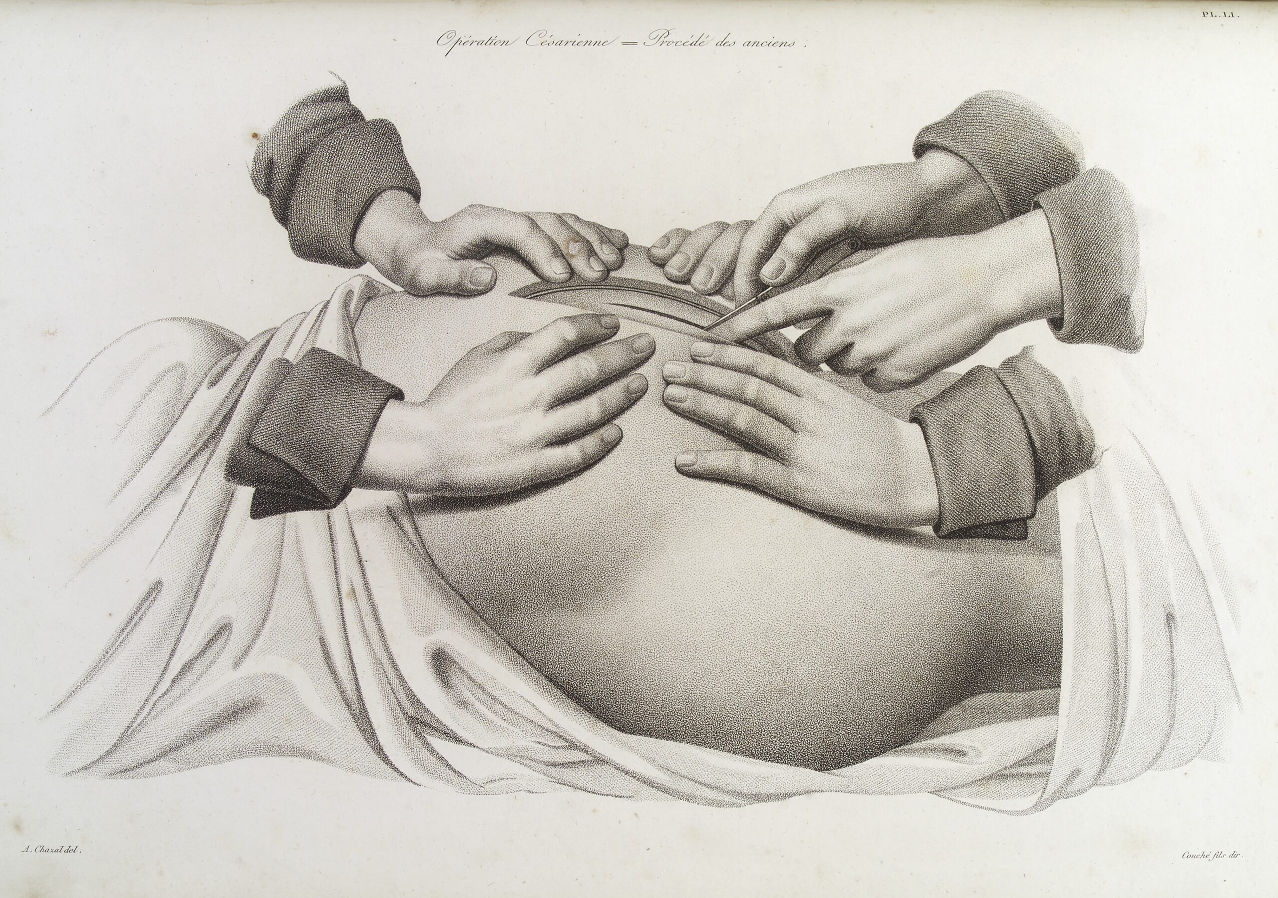 The Stages of Conception to Delivery in Obstetrics