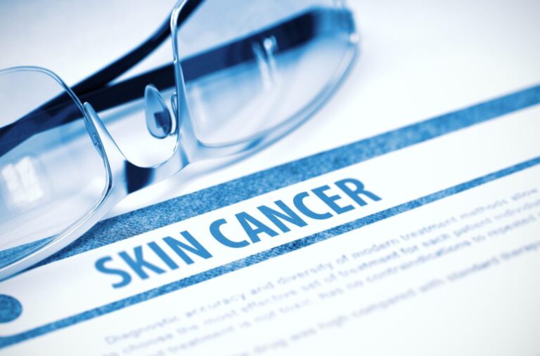 Understanding Skin Cancer Treatments and What to Expect