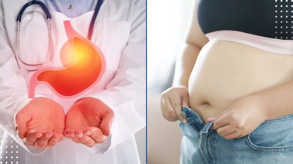 Understanding the Long-Term Benefits of Gastric Bypass Surgery
