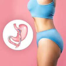 Understanding the Risks and Benefits of Weight Loss Surgery