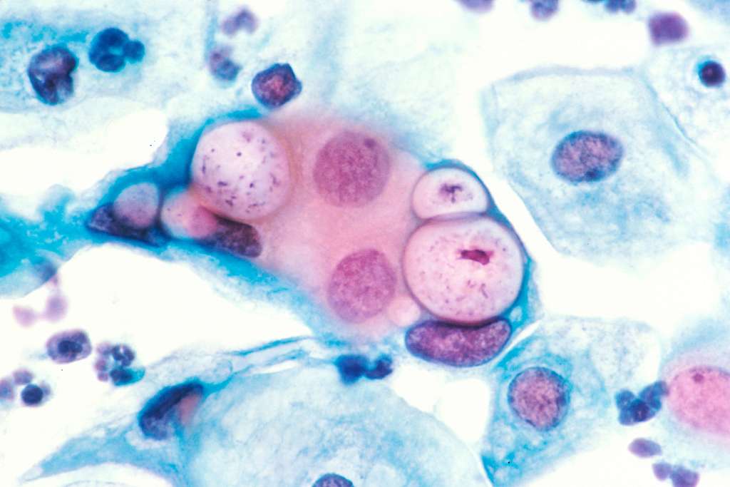 What To Expect During a Pap Smear and Why It's Needed