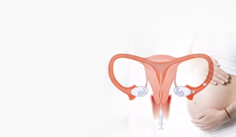 When Is Insemination the Best Option for Fertility Treatment?