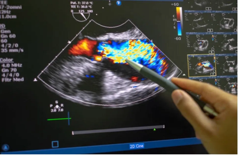 4 Things That Impact Ultrasound and MRI Image Quality