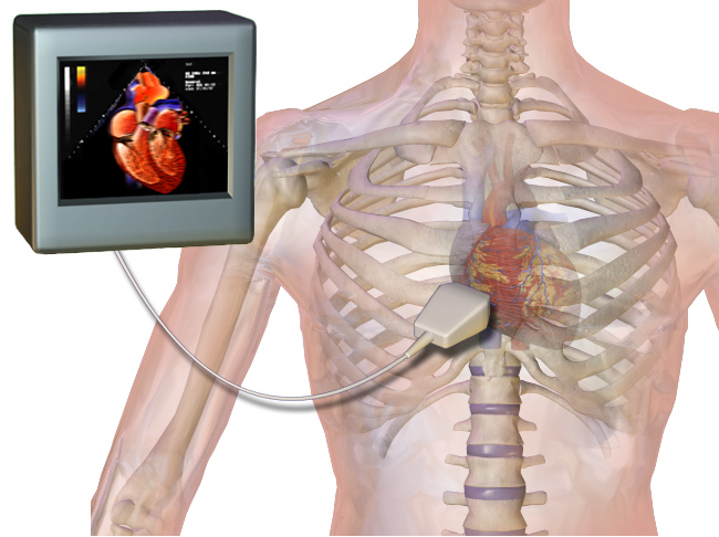 Echocardiograms Explained: What They Can Tell You About Your Heart