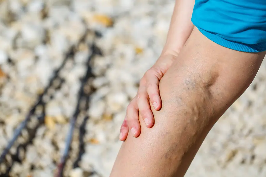 How Diet and Nutrition Impact Joint Pain and Inflammation