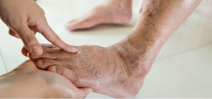 How Vascular Surgeons Diagnose and Treat Peripheral Artery Disease