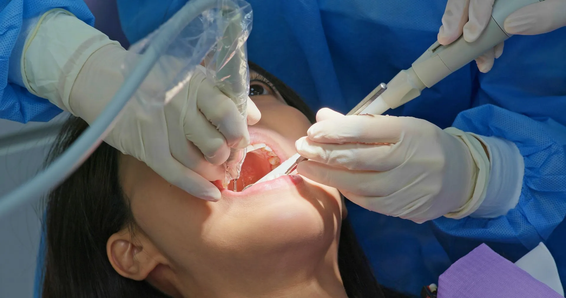 How a Dentist Determines You Need a Root Canal