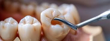 The Importance of Consulting an Oral Surgeon for Major Procedures