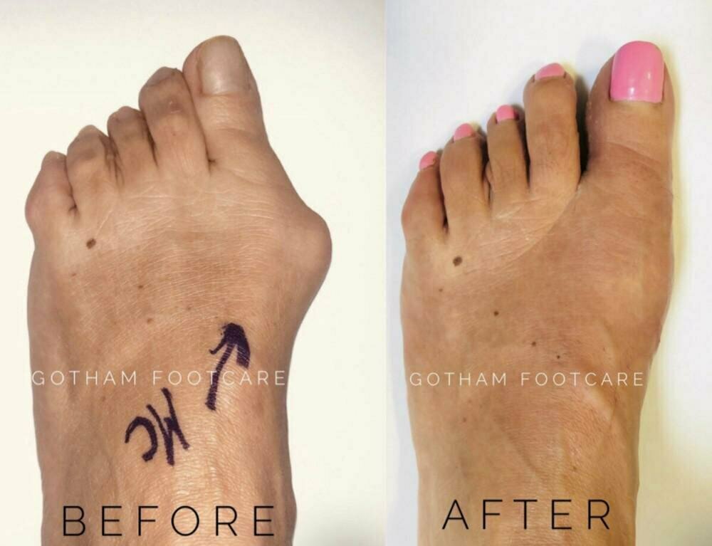What Are the Most Common Foot Conditions Podiatrists Treat?