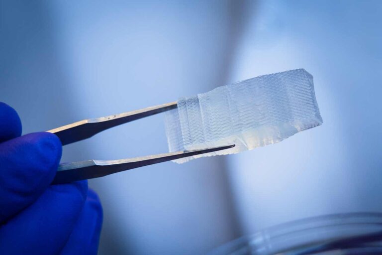 Innovative Techniques in Stem Cell Therapy for Injury Recovery