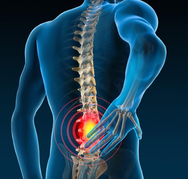 Understanding the Process of Spinal Cord Stimulation Implantation: What to Expect