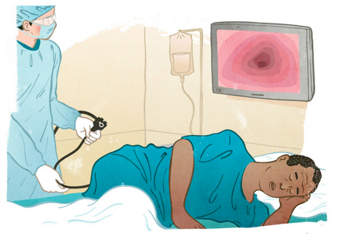 What Are Some Early Signs of Colon Cancer