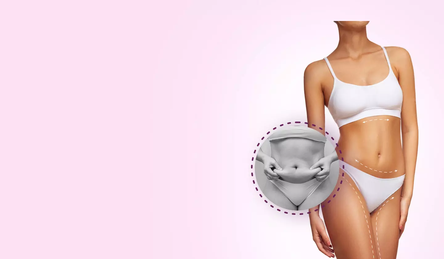 What To Expect Before, During, and After Liposuction
