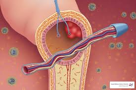 Exploring the Connection Between Vascular Disease and Diabetes