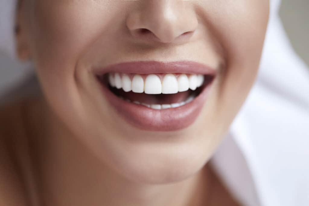 Enhancing Your Smile With Porcelain Versus Composite Veneers
