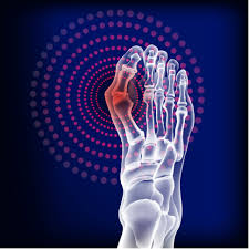 Exploring Approaches to Arthritis Treatment
