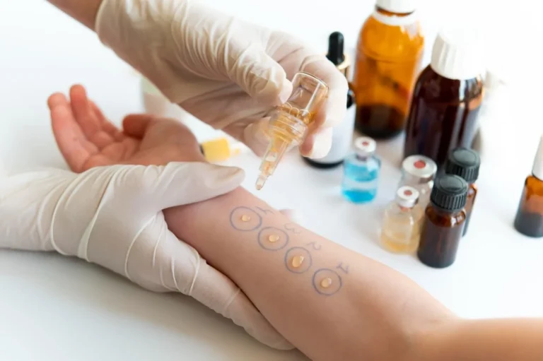 How Allergy Testing Can Help Identify Hidden Triggers