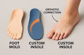 How Custom Orthotics Can Improve Your Overall Foot Health