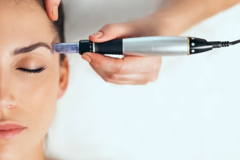 Understanding if Skin Rejuvenation Is Right for You