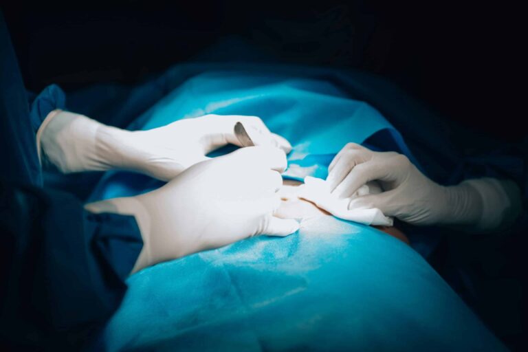 Understanding the Physical Effects of a Hysterectomy