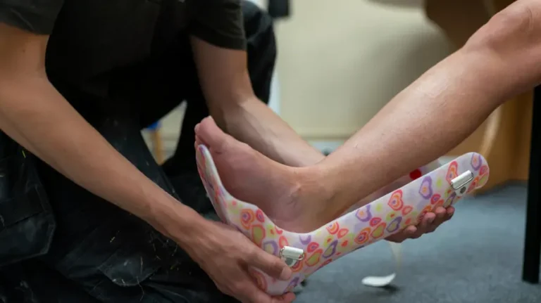 Why Choosing the Right Foot and Ankle Specialists Matters